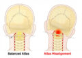 The Cranial-to-Distal Areas of Influence of Atlas Therapy